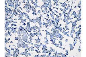 (ABIN185488) Negative Control showing staining of paraffin embedded Human Placenta, with no primary antibody.