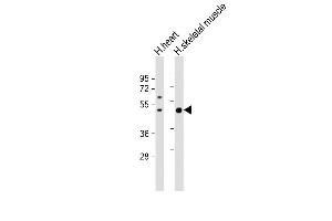 All lanes : Anti-ISLR Antibody (C-term) at 1:1000 dilution Lane 1: human heart lysate Lane 2: human skeletal muscle lysate Lysates/proteins at 20 μg per lane.