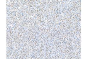 anti-Proteasome (Prosome, Macropain) 26S Subunit, Non-ATPase, 1 (PSMD1) (AA 903-953) antibody