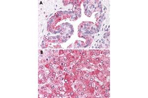 Immunohistochemical staining of formalin-fixed, paraffin-embedded human prostate (A) and human liver (B) tissue after heat-induced antigen retrieval. (ERAP1 anticorps  (Internal Region))