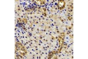 Immunohistochemical analysis of DDX39A staining in mouse kidney formalin fixed paraffin embedded tissue section. (DDX39 anticorps)