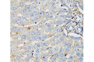 Immunohistochemistry of paraffin-embedded Rat liver using PROCR Polyclonal Antibody at dilution of 1:200 (40x lens). (PROCR anticorps)