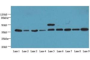 Western Blotting (WB) image for anti-Glyceraldehyde-3-Phosphate Dehydrogenase (GAPDH) (AA 3-105) antibody (ABIN2931072) (GAPDH anticorps  (AA 3-105))