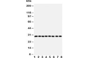 Western blot testing of CISH antibody and Lane 1:  rat liver;  2: rat kidney; and human samples  3: placenta;  4: A431;  5: SMMC-7721;  6: HeLa;  7: COLO320;  8: MM231 cell lysate