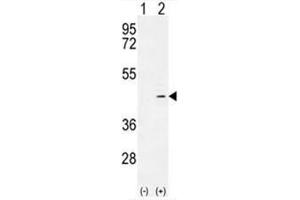 Western blot analysis of ADH4 (arrow) using rabbit polyclonal ADH4 Antibody (C-term) . (ADH4 anticorps  (C-Term))