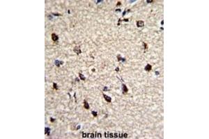 Immunohistochemistry (IHC) image for anti-Dermatopontin (DPT) antibody (ABIN3003244)