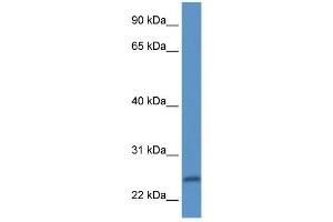 Western Blot showing PI15 antibody used at a concentration of 1 ug/ml against Fetal Heart Lysate (PI15 anticorps  (N-Term))