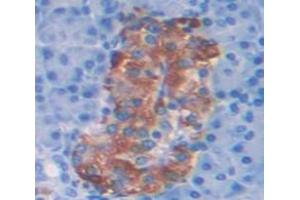 Figure. (HIST1H2AH anticorps  (AA 1-128))