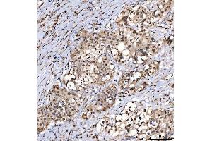 IHC analysis of SNRPD2 using anti-SNRPD2 antibody (ABIN7598963). (SNRPD2 anticorps  (AA 1-118))