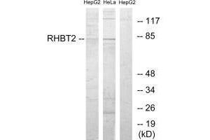 Western blot analysis of extracts from HepG2 cells and HeLa cells, using RHBT2 antibody. (RHOBTB2 anticorps)