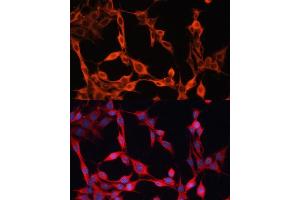 Immunofluorescence analysis of NIH/3T3 cells using SLC25 antibody  at dilution of 1:100.