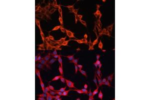 Immunofluorescence analysis of NIH/3T3 cells using SLC25 antibody  at dilution of 1:100. (SLC25A23 anticorps  (AA 1-160))