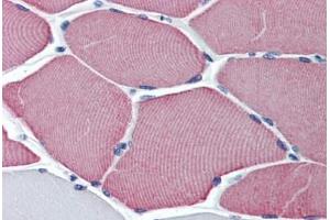 Human Skeletal Muscle: Formalin-Fixed, Paraffin-Embedded (FFPE) (TNNC1 anticorps  (AA 1-162))