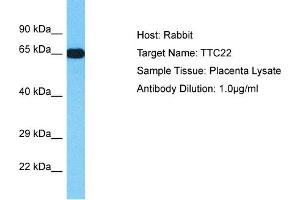 Host: Rabbit Target Name: TTC22 Sample Type: Placenta lysates Antibody Dilution: 1. (TTC22 anticorps  (N-Term))