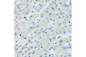 Immunohistochemistry of paraffin-embedded human liver using SLC5A6 antibody (ABIN6292573) at dilution of 1:100 (40x lens).