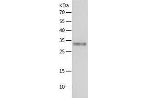 Western Blotting (WB) image for Protein Tyrosine Phosphatase, Receptor Type, N (PTPRN) (AA 693-979) protein (His tag) (ABIN7124688) (PTPRN Protein (AA 693-979) (His tag))