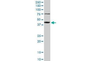 ABHD5 monoclonal antibody (M01), clone 1F3. (ABHD5 anticorps  (AA 1-349))