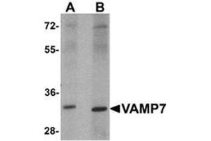 Western blot analysis of VAMP7 in mouse lung tissue lysate with VAMP7 Antibody  at 1 ug/mL. (VAMP7 anticorps  (N-Term))