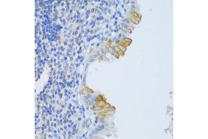 Immunohistochemistry of paraffin-embedded human appendix using CRA antibody (ABIN6132087, ABIN6138999, ABIN6139001 and ABIN6217973) at dilution of 1:150 (40x lens).