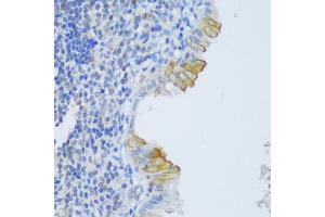 Immunohistochemistry of paraffin-embedded human appendix using CRA antibody (ABIN6132087, ABIN6138999, ABIN6139001 and ABIN6217973) at dilution of 1:150 (40x lens). (EFCAB4B anticorps  (AA 1-200))