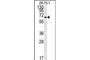 N4BP3 Antibody (N-term) (ABIN651821 and ABIN2840413) western blot analysis in ZR-75-1 cell line lysates (15 μg/lane). (N4BP3 anticorps  (N-Term))