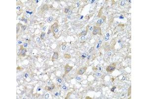 Immunohistochemistry of paraffin-embedded Rat brain using MTX1 Polyclonal Antibody at dilution of 1:100 (40x lens).