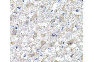 Immunohistochemistry of paraffin-embedded Rat brain using MTX1 Polyclonal Antibody at dilution of 1:100 (40x lens).