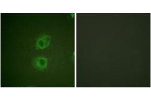 Immunofluorescence analysis of HuvEc cells, using HER3 (Ab-1222) Antibody. (ERBB3 anticorps  (AA 1191-1240))