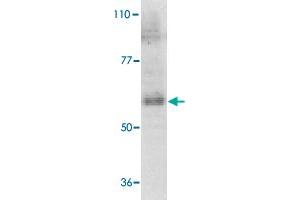 Western blot analysis of IL21R expression in human Raji cell lysate with IL21R polyclonal antibody  at 1 ug /mL . (IL21 Receptor anticorps  (AA 97-111))