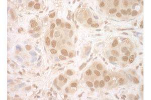 Immunohistochemistry (IHC) image for anti-Nuclear Cap Binding Protein Subunit 2 (NCBP2) (AA 1-50) antibody (ABIN7453939)