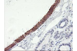 Immunohistochemical staining of paraffin-embedded Human breast tissue using anti-C20orf3 mouse monoclonal antibody. (APMAP anticorps)