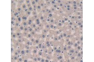 IHC-P analysis of Rat Tissue, with DAB staining. (Complement Factor B anticorps  (AA 476-592))