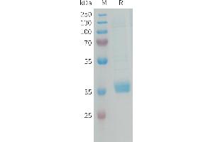 Human M Protein, His Tag on SDS-PAGE under reducing condition.