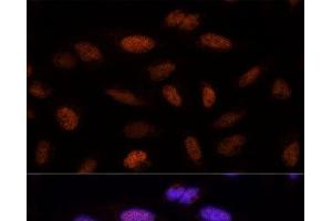 Immunofluorescence analysis of U-2 OS cells using ADNP Polyclonal Antibody at dilution of 1:100 (40x lens). (ADNP anticorps)