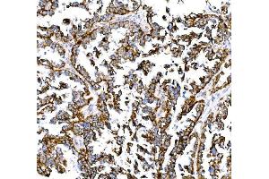 IHC analysis of BCKDHA using anti-BCKDHA antibody (ABIN7601223).