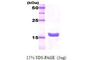 Figure annotation denotes ug of protein loaded and % gel used. (Pituitary Growth Hormone 20kDa Protéine)
