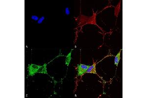 Immunocytochemistry/Immunofluorescence analysis using Mouse Anti-GABA-B Receptor 2 Monoclonal Antibody, Clone S81-2 (ABIN2484085).