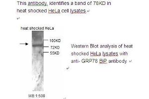 Image no. 1 for anti-Heat Shock 70kDa Protein 5 (Glucose-Regulated Protein, 78kDa) (HSPA5) antibody (ABIN790797) (GRP78 anticorps)
