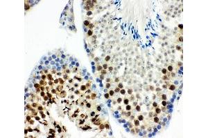 IHC-P: MCAK antibody testing of mouse testis tissue (KIF2C anticorps  (AA 531-725))