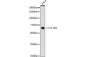 Western blot analysis of extracts of HeLa cells, using ZNF384 antibody (ABIN7271478) at 1:1000 dilution. (ZNF384 anticorps  (AA 1-180))