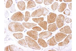Immunohistochemistry (IHC) image for anti-Protein Kinase, AMP-Activated, alpha 1 Catalytic Subunit (PRKAA1) (AA 350-400) antibody (ABIN7448407)