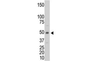 Western Blotting (WB) image for anti-Creatine Kinase, Muscle (CKM) antibody (ABIN3002974)