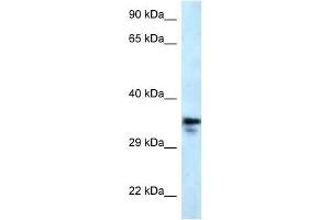 Western Blot showing MMACHC antibody used at a concentration of 1 ug/ml against U937 Cell Lysate (MMACHC anticorps  (C-Term))