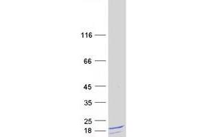 Validation with Western Blot