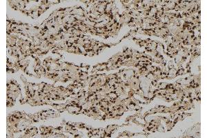 ABIN6272311 at 1/100 staining Human lung tissue by IHC-P. (GZMH anticorps)
