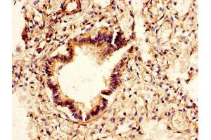 IHC image of ABIN7147557 diluted at 1:400 and staining in paraffin-embedded human lung tissue performed on a Leica BondTM system. (CHI3L2 anticorps  (AA 27-390))