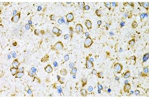 Immunohistochemistry of paraffin-embedded Rat brain using LRPAP1 Polyclonal Antibody at dilution of 1:200 (40x lens). (LRPAP1 anticorps)
