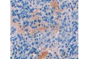 Used in DAB staining on fromalin fixed paraffin- embedded Kidney tissue (CBL anticorps  (AA 558-816))