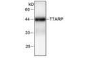 Image no. 1 for anti-tyrosyl-DNA phosphodiesterase 2 (TDP2) antibody (ABIN791474)