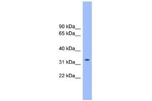 WB Suggested Anti-SLC25A1 Antibody Titration:  0. (Slc25a1 anticorps  (Middle Region))